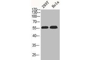 Western Blot analysis of 293T HELA cells using Phospho-Akt1/3 (Y437/434) Polyclonal Antibody (AKT1/3 (pTyr434), (pTyr437) anticorps)
