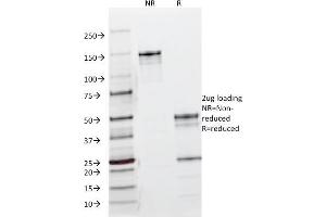 SDS-PAGE Analysis Purified EGFR Mouse Monoclonal Antibody (B1D8). (EGFR anticorps)