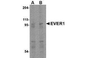 Image no. 1 for anti-Transmembrane Channel-Like 6 (TMC6) (Internal Region) antibody (ABIN1493617) (TMC6 anticorps  (Internal Region))