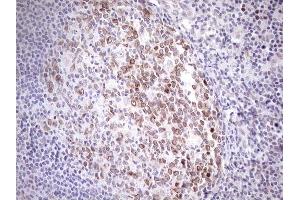 Immunohistochemistry (IHC) image for anti-Achalasia, Adrenocortical Insufficiency, Alacrimia (AAAS) (AA 322-546) antibody (ABIN2715861)
