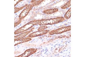 Immunohistochemistry of paraffin-embedded rat kidney using GEMIN5 antibody (ABIN7267367) at dilution of 1:100 (40x lens).