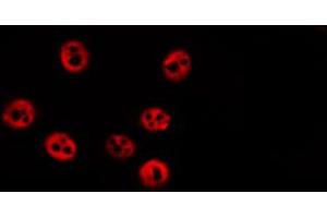ABIN6274034 staining HepG2 by IF/ICC. (RPS6KA1 anticorps  (pSer363, pThr359))