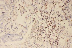 IHC analysis of Profilin 1 using anti-Profilin 1 antibody (ABIN3043603). (PFN1 anticorps  (C-Term))