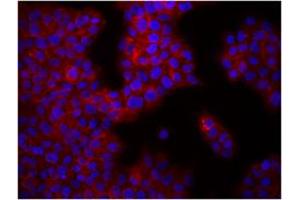 Image no. 1 for anti-Integrin beta 1 (ITGB1) antibody (ABIN205424) (ITGB1 anticorps)