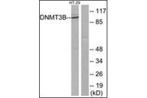 Western blot analysis of extracts from HT-29 cells, using DNMT3B Antibody. (DNMT3B anticorps  (N-Term))