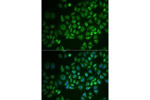Immunofluorescence analysis of A549 cells using GPLD1 antibody (ABIN5973975). (GPLD1 anticorps)