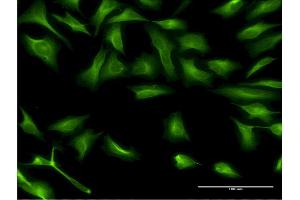 Immunofluorescence of monoclonal antibody to DCP1A on HeLa cell. (DCP1A anticorps  (AA 186-285))