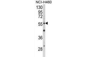Western Blotting (WB) image for anti-V-Akt Murine Thymoma Viral Oncogene Homolog 2 (AKT2) antibody (ABIN5022918) (AKT2 anticorps)
