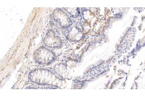 Detection of HRG in Rat Small intestine Tissue using Monoclonal Antibody to Histidine Rich Glycoprotein (HRG)