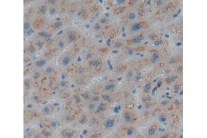 Used in DAB staining on fromalin fixed paraffin- embedded liver tissue