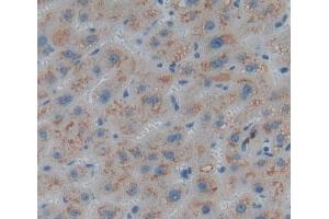 Used in DAB staining on fromalin fixed paraffin- embedded liver tissue (AADAT anticorps  (AA 202-425))