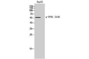 Western Blotting (WB) image for anti-Tryptophan Hydroxylase 2 (TPH2) (pSer19) antibody (ABIN3182390) (Tryptophan Hydroxylase 2 anticorps  (pSer19))
