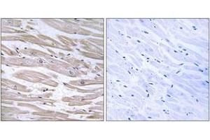 Immunohistochemistry analysis of paraffin-embedded human heart tissue, using DNAJB11 Antibody.