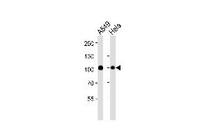 Western blot analysis of lysates from A549,Hela cell line (from left to right),using Uba2 Antibody (ABIN484072 and ABIN1533453). (UBA2 anticorps)