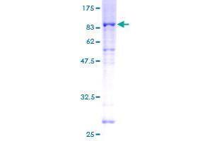 SDS-PAGE (SDS) image for serine/threonine Kinase 38 Like (STK38L) protein (GST tag) (ABIN1321702)