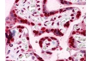 Immunohistochemistry (IHC) image for anti-High Mobility Group Box 2 (HMGB2) (AA 1-196) antibody (ABIN614619)