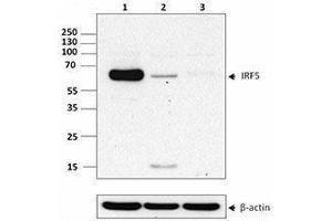 Western Blotting (WB) image for anti-Interferon Regulatory Factor 5 (IRF5) antibody (ABIN2666392) (IRF5 anticorps)