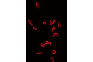 ABIN6268879 staining LOVO by IF/ICC. (Actin anticorps  (N-Term))