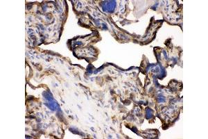 IHC analysis of TFRC using anti-TFRC antibody (ABIN3043538). (Transferrin Receptor anticorps  (AA 1-198))