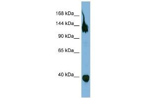 WB Suggested Anti-SEMA6A Antibody Titration:  0. (SEMA6A anticorps  (Middle Region))