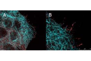 Immunofluorescence (IF) image for anti-V-Akt Murine Thymoma Viral Oncogene Homolog 1 (AKT1) (Ser473) antibody (ABIN400784) (AKT1 anticorps  (Ser473))