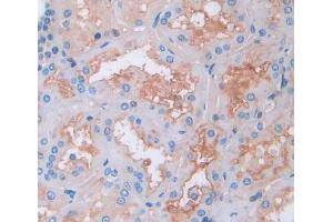 IHC-P analysis of kidney tissue, with DAB staining. (SSR1 anticorps  (AA 19-286))
