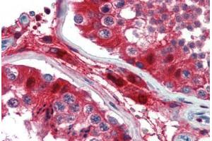 Human Testis (formalin-fixed, paraffin-embedded) stained with GATA3 antibody ABIN462169 followed by biotinylated goat anti-rabbit IgG secondary antibody ABIN481713, alkaline phosphatase-streptavidin and chromogen. (GATA3 anticorps  (AA 36-85))
