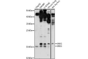 Western blot analysis of extracts of various cell lines, using EREG antibody (ABIN7266994) at 1:1000 dilution.