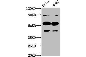 Western Blot Positive WB detected in: Hela whole cell lysate, K562 whole cell lysate All lanes: CYP7A1 antibody at 4. (CYP7A1 anticorps  (AA 303-423))