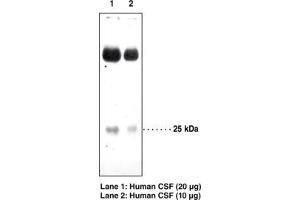 Image no. 1 for anti-Prostaglandin D2 Synthase (PTGDS) antibody (ABIN2451689) (PTGDS anticorps)