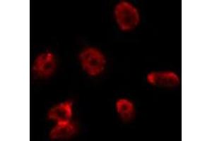 ABIN6275688 staining Hela by IF/ICC. (ZC3H8 anticorps  (Internal Region))