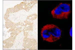 Immunohistochemistry (IHC) image for anti-C-Abl Oncogene 1, Non-Receptor tyrosine Kinase (ABL1) (AA 850-900) antibody (ABIN7455217)
