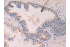 Detection of CHRD in Human Prostate Tissue using Polyclonal Antibody to Chordin (CHRD)