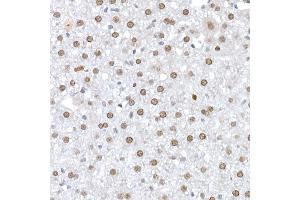 Immunohistochemistry of paraffin-embedded human liver using IL6ST Rabbit pAb (ABIN7268004) at dilution of 1:100 (40x lens).