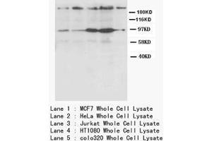CXCR4 Polyclonal Antibody (CXCR4 anticorps  (N-Term))