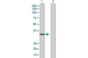 Western Blot analysis of ADAMTS4 expression in transfected 293T cell line by ADAMTS4 MaxPab polyclonal antibody. (ADAMTS4 anticorps  (AA 1-339))