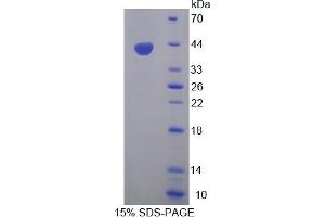 Image no. 1 for Wingless-Type MMTV Integration Site Family, Member 3A (WNT3A) (AA 1-284) protein (His tag) (ABIN4991038)