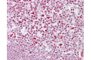 Anti-NFATC3 antibody IHC of human thymus. (NFATC3 anticorps  (AA 324-373))