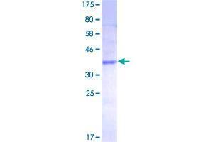 Image no. 1 for Chemokine (C-C Motif) Ligand 27 (CCL27) (AA 1-112) protein (GST tag) (ABIN1348404)