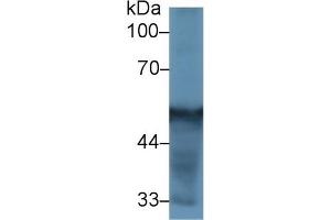 Detection of CYP2D6 in Rat Liver lysate using Polyclonal Antibody to Cytochrome P450 2D6 (CYP2D6) (CYP2D6 anticorps  (AA 236-472))