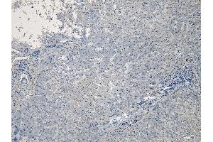 (ABIN185371) Negative Control showing staining of paraffin embedded Human Liver, with no primary antibody.