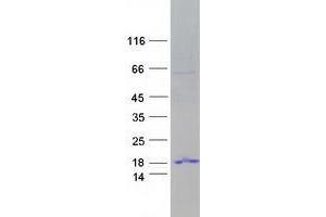 Validation with Western Blot (TP53 Target 3 (TP53TG3) protein (Myc-DYKDDDDK Tag))
