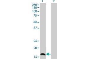 Western Blot analysis of IFNA2 expression in transfected 293T cell line by IFNA2 monoclonal antibody (M36), clone 2C10.
