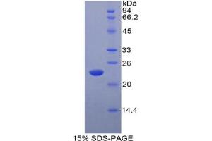 SDS-PAGE analysis of Rat Interferon alpha 5 Protein.