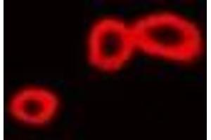 Immunofluorescent analysis of ST3GAL4 staining in Hela cells.