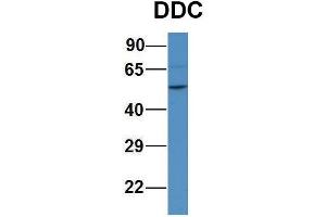 WB Suggested Anti-DDC Antibody Titration:  1ug/ml  Positive Control:  Human 293T cell lysate (DDC anticorps  (N-Term))