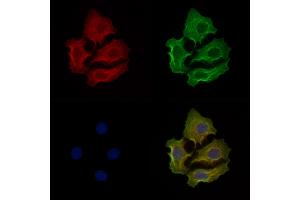 Phospho-Tryptophan Hydroxylase (Ser260) Antibody staining Hela cells(heat shock treatment) by IF/ICC.
