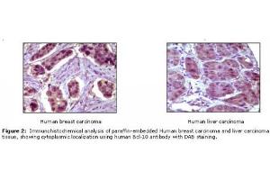 Image no. 1 for anti-B-Cell CLL/lymphoma 10 (BCL10) antibody (ABIN207592) (BCL10 anticorps)