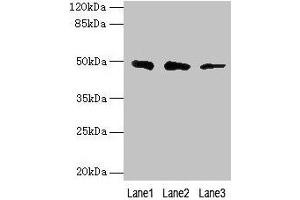 Western blot All lanes: ZBTB6 antibody at 8 μg/mL Lane 1: Hela whole cell lysate Lane 2: HepG2 whole cell lysate Lane 3: 293T whole cell lysate Secondary Goat polyclonal to rabbit IgG at 1/10000 dilution Predicted band size: 49 kDa Observed band size: 49 kDa (ZBTB6 anticorps  (AA 115-424))