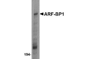 Western Blotting (WB) image for anti-HECT, UBA and WWE Domain Containing 1, E3 Ubiquitin Protein Ligase (HUWE1) (C-Term) antibody (ABIN1030253) (HUWE1 anticorps  (C-Term))